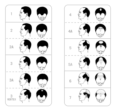 hairchart.jpg